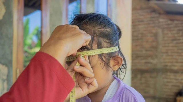 Ilustrasi anak stunting. Foto: Shutterstock
